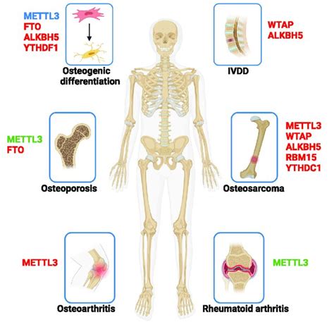 Bone Diseases - MedlinePlus - muktibox.com