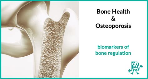 Bone Health & Osteoporosis | NIAMS - muktibox.com