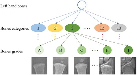 bone-age-assessment/README.md at main - GitHub - muktibox.com