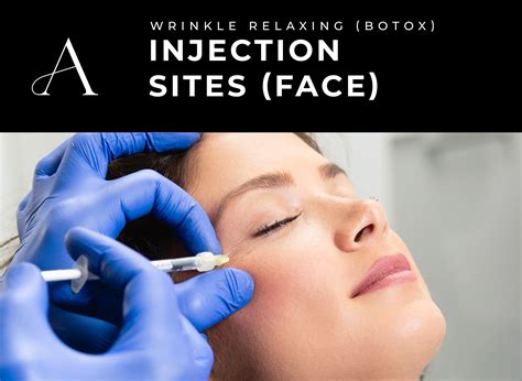 Botox Injections - coolestguyplanet.net
