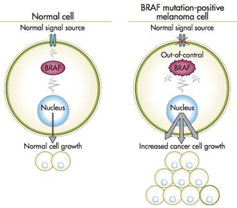 BRAF mutation in melanoma Definition testing and treatment