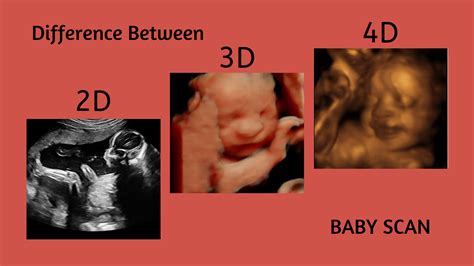 Baby 4D: Hey Baby Ultrasound image 1