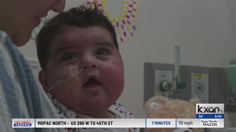 Baby receives successful heart transplant at Dell Children's hospital