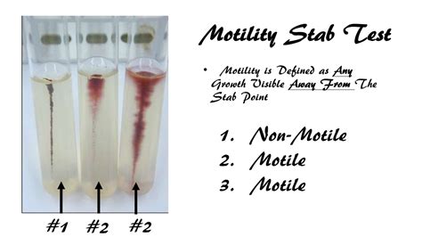 Bacillus Subtilis Motility Test
