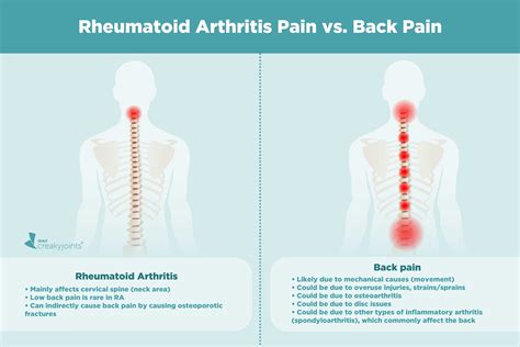 Back Pain in Rheumatoid Arthritis: What Causes It, and