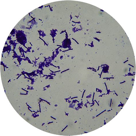 Bacteria in Yoghurt - Microscope.com