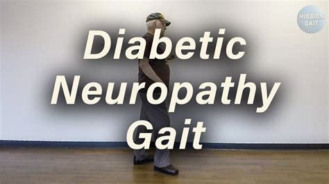 Balance and Gait in Diabetic Neuropathy - Full Text View ...