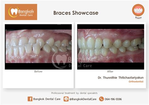 Bangkok dental