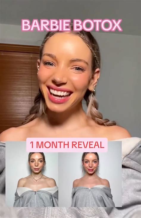 Barbie botox. The Vanderpump Rules alum, 35, took to her Instagram Story on Thursday, February 8, to reveal the before and after photos following a "Barbie Botox" procedure. Stassi Schroeder raved over 'Barbie ... 