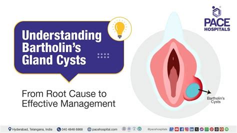 Bartholin Gland Understanding Its Function, Common Issues, and
