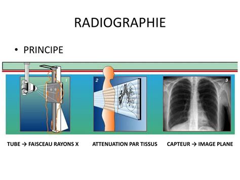 Bases physiques de la radiographie des parties molles, application à la mammographie. - Honda legend ka9 1996 2004 repair service manual.