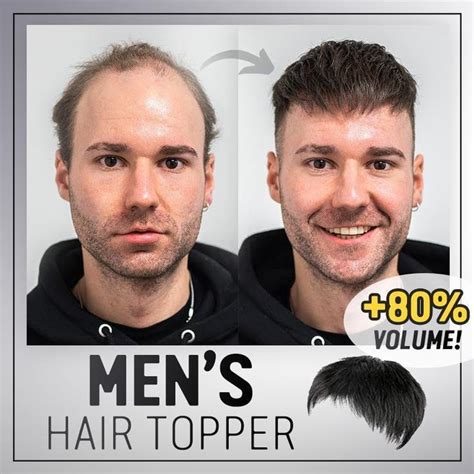 Basic Concepts of Mens Hair Toppers