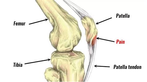 Basic Concepts of Patella Tendon Bearing