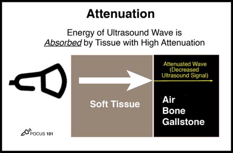 Basic Principles of Ultrasound Physics and Artifacts Made Easy