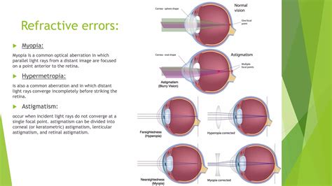 Basic eye terms.  Aberration are divided into two main categories: higher-order and lo...