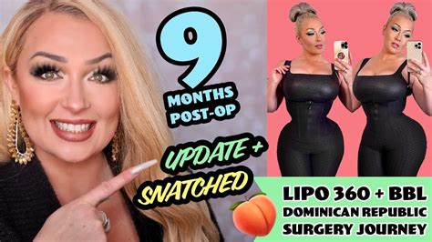 May 25, 2021 · New York City mother-of-two, 30, dies from complications following plastic surgery in the Dominican Republic. Jesmy Tapia, a resident of New York City, died in the Dominican Republic on Sunday due ... . 