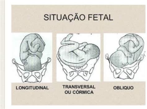 Bebê transversal - Outubro de 2024 - BabyCenter