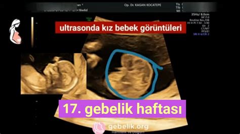 Bebek ultrasonda kacinci haftada gorunur