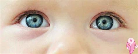 Bebeklerde astigmat nasıl anlaşılır