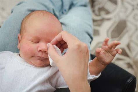 Bebeklerde göz kızarmasına ne iyi gelir