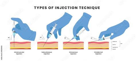 Because jab co uses different methods.  When we use because, we are focusing on th...