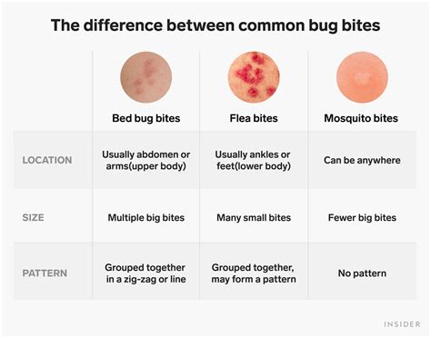 Bed Bug vs Flea Bites: Differences, How to Treat & Removing