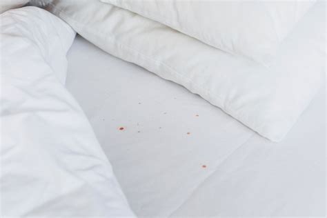 Bed bug stains on sheets. Bed bugs are small, wingless insects that live in apartments, hotel rooms, cruise ships, buses, trains, and other places where people gather. Adult bed bugs are about the size of an apple seed and have a brownish-red color. Young bed bugs, or nymphs, are smaller and have a transparent yellowish color. Bed bugs feed on human … 