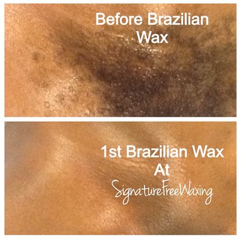 Before and after brazilian bikini wax. During the service your Waxing Professional willguide you through the process of the service and the positions of getting waxed. You can feel comfortable and confident they will ask questions and guide you. View 100's of brazilian wax before and after photos. Close up and detailed. 