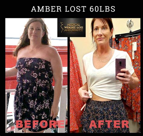 Before and after phentermine. After 12 weeks at this maintenance dosage, if the patient has not lost at least 5% of body weight, Contrave should be discontinued. How to take phentermine for best results. Phentermine should be … 