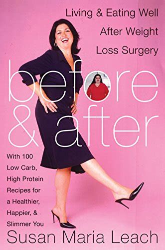 Read Online Before  After Living And Eating Well After Weightloss Surgery By Susan Maria Leach