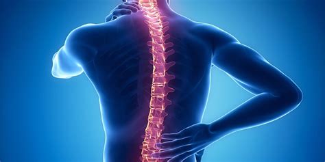 Bel Fıtığı Tedavisinde Epidural Enjeksiyonlar Uzm. Dr. Ahmet . 