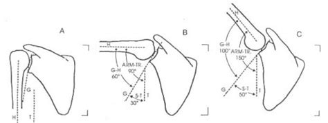 Bench Press – Mechanics and Scapulo-Humeral Rhythm