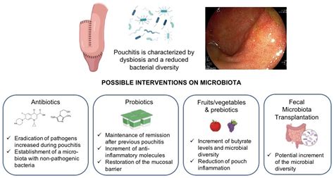 Best Antibiotic for Pouchitis? The J-Pouch Group