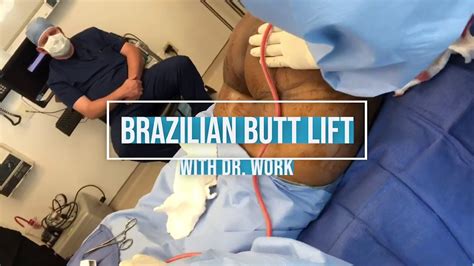 Best Brazilian Butt Lift Cleveland, Ohio Dr. Gregory Fedele