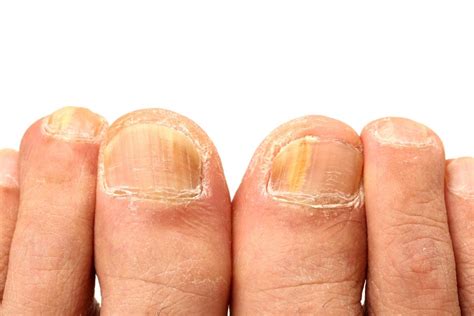 Best Candidiasis of Skin and Nails Doctors in Franklin, TN