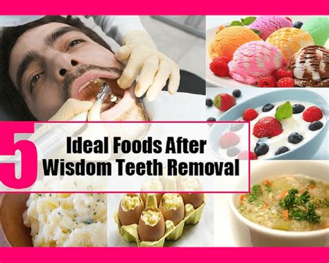 Best Foods to Eat After Wisdom Teeth Removal ABQ