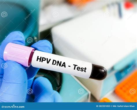 Best Human Papillomavirus DNA Testing Doctors in Avon, OH