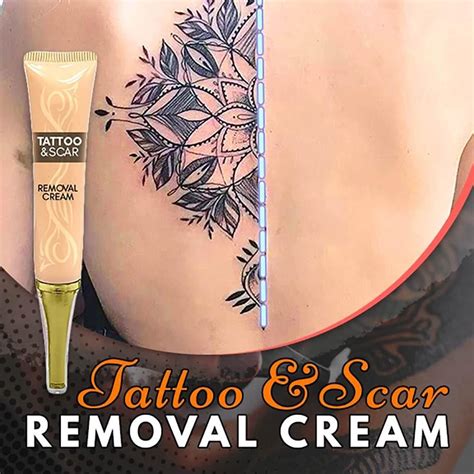 Best Numbing Cream for Tattoo Removal in 2024 [Top 10 Picks]