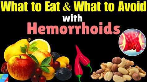 Best and Worst Foods for Hemorrhoids - ddcoc.com