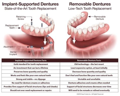 Best dental insurance for dentures. Things To Know About Best dental insurance for dentures. 