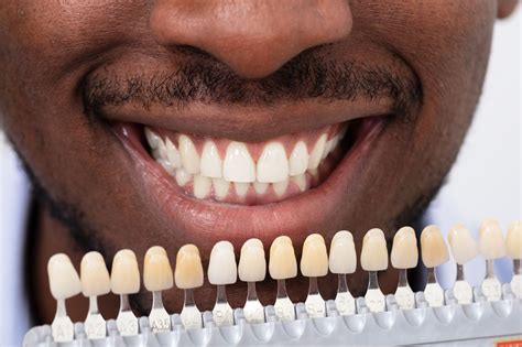 Best dental insurance for veneers. Sep 11, 2023 · Because veneers are typically considered cosmetic, it’s unlikely that dental insurance will cover all or even some of the cost. You can expect to pay between $250 and $1,500 per tooth, says Dr ... 