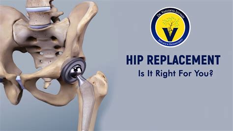 Best hip surgeon near me. Things To Know About Best hip surgeon near me. 