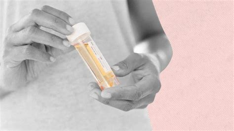 Best kidney tests How to check kidney function at home
