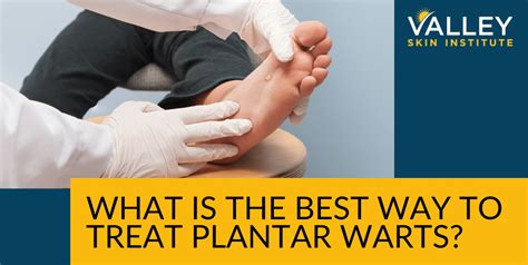 Best treatment for plantar warts. .  <a href=https://logus-ekb.ru/nglztx/nu...