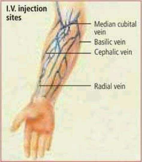 Best veins for iv injection.  Understanding IV Injection Sites IV injection sites Diagra...