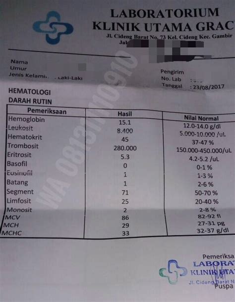 Biaya Tes Cd4 Cek Jumlah Normal Sel Darah Putih Pengidap Hiv