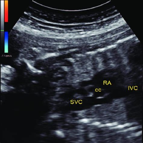 Bicav Halı ve Koltuk Yıkama