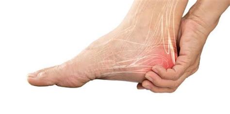 Doctors & departments Overview Foot drop, sometimes called drop foot, is a general term for difficulty lifting the front part of the foot. If you have foot drop, the front …. 