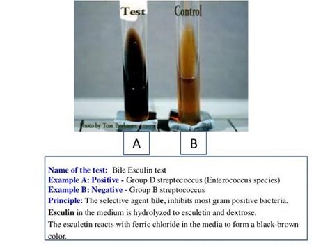 Bile Esculin Test Bile Esculin Test For Enterococcus Identification