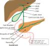 Biliary Atresia - StatPearls - NCBI Bookshelf